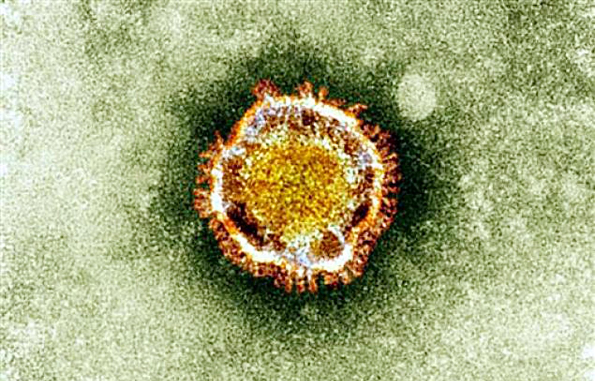 Coronavirus, SMI: «Nous, les médecins, n'avons ni masque ni gants. Les régions sont incapables de s'adapter Coronavirus, SMI: «Nous, les médecins, n'avons ni masque ni gants. Les régions sont incapables de s'adapter