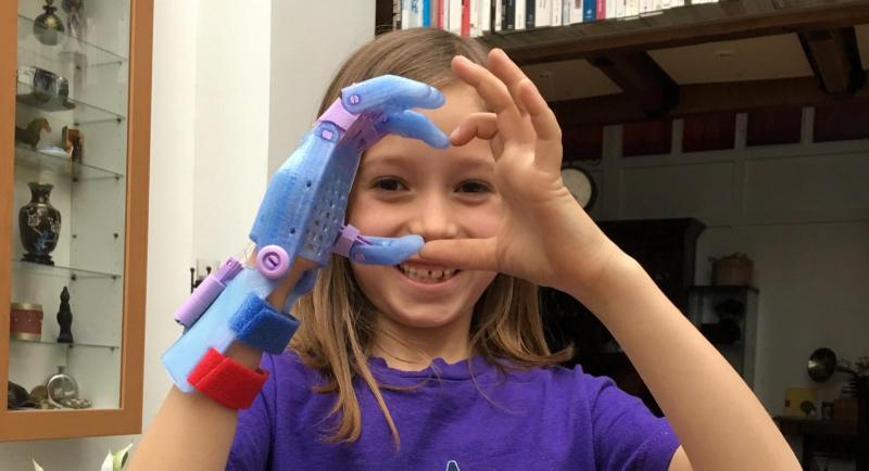 Les prothèses permettent aux enfants de retrouver le sourire...